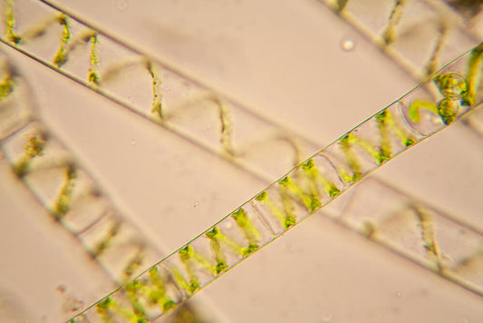 What Causes Cyanobacteria? 7 Factors That Cause Pond Algae to Grow